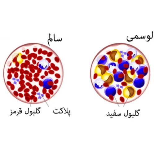 درمان انواع سرطان با  داروی ونتوکلاکس (Venetoclax)