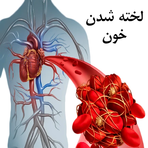 سابقه لخته شدن خون از موارد احتیاطی مصرف داروی ورینوستات