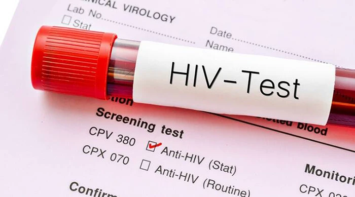 آزمایش های خونی از راه های تشخیص بیماری ایدز