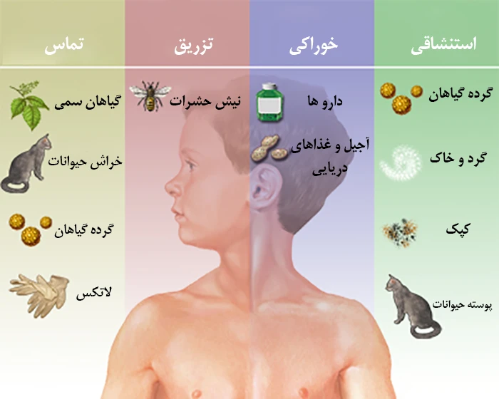 عوامل محرک از علل ابتلا به آلرژی و حساسیت