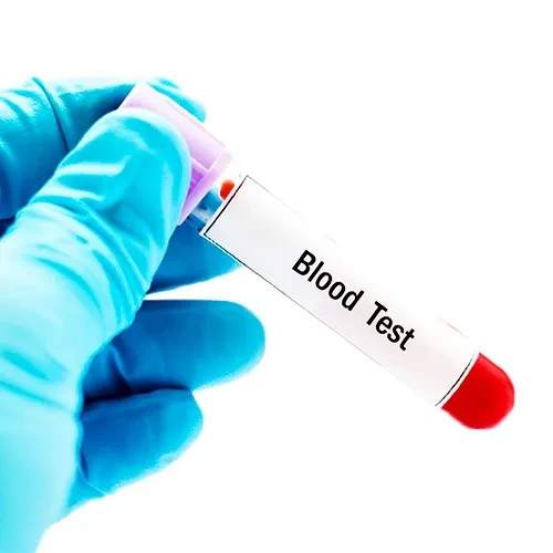 آزمایش خون برای تشخیص سرطان های منشا ناشناخته