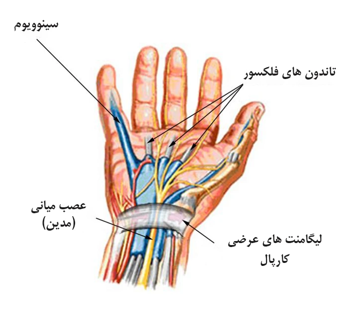 سندرم تونل کارپالدر نتیجه فشار بر عصب میانی دست