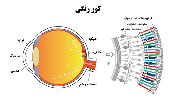 کوررنگی چیست؟