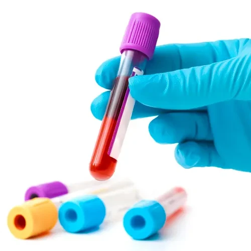 آزمایش خون از راه های تشخیص تومور کرانیوفارنژیوم