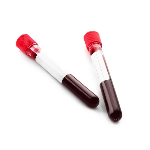 آزمایش خون از راه های تشخیص لنفوم سلول های تی پوستی