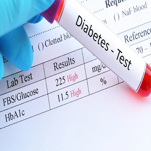 آزمایش های تشخیصی ابتلا به دیابت