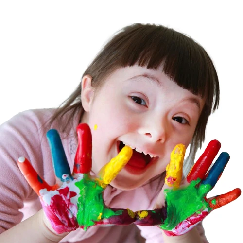 سندرم داون چیست؟