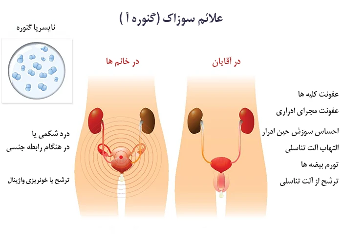 علائم ابتلا به عفونت گونوره آ