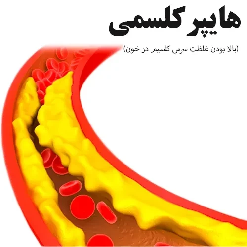 عارضه هایپرکلسمی