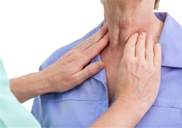 بزرگ شدن تیروئید از علائم پرکاری تیروئید (هایپرتیروئیدیسم)