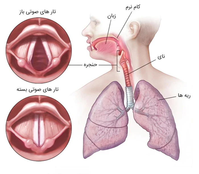 علل ابتلا به التهاب حنجره (لارنژیت)