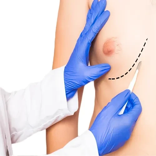 جراحی سرطان پستان مردان
