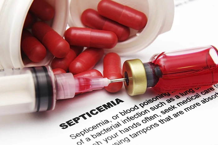 آزمایش خون از راه های تشخیص عارضه سپتیسمیا