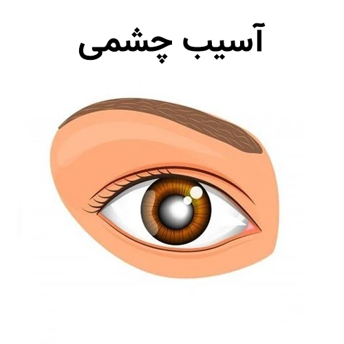 آسیب چشمی از موارد احتیاطی مصرف قطره نفازولین چشمی