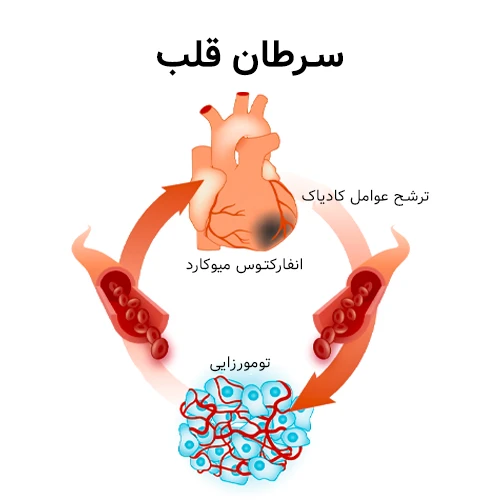 سرطان قلب