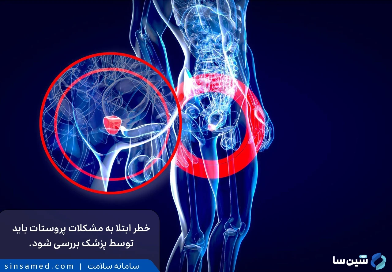 مشکلات پروستات از موارد احتیاطی مصرف آمپول تستوسترون