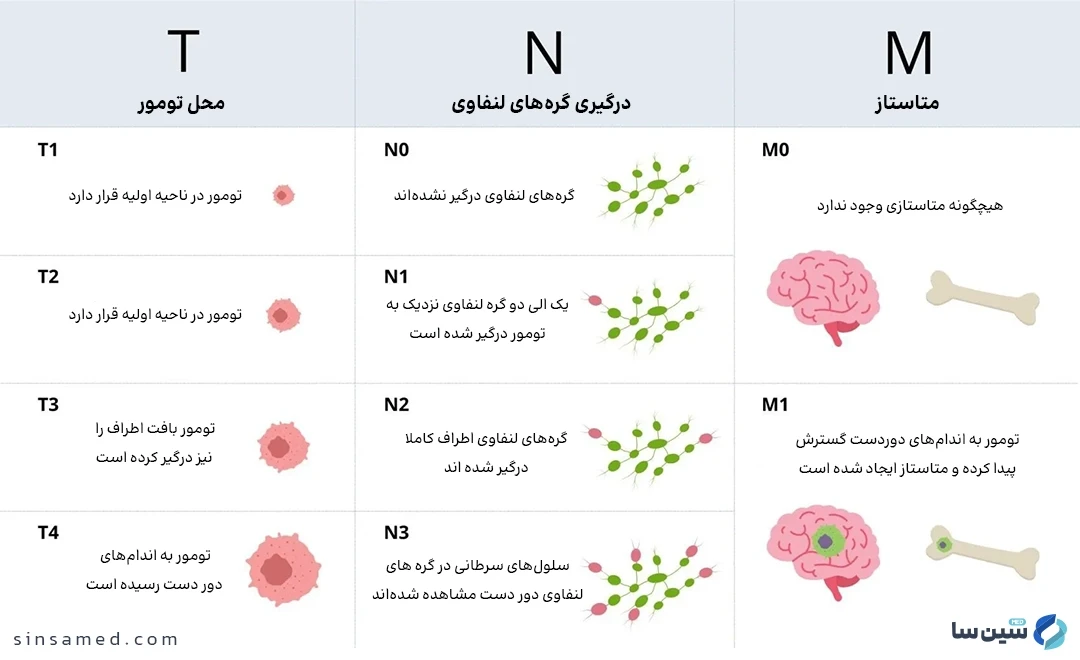 سیستم تی ان ام برای مرحله بندی سرطان