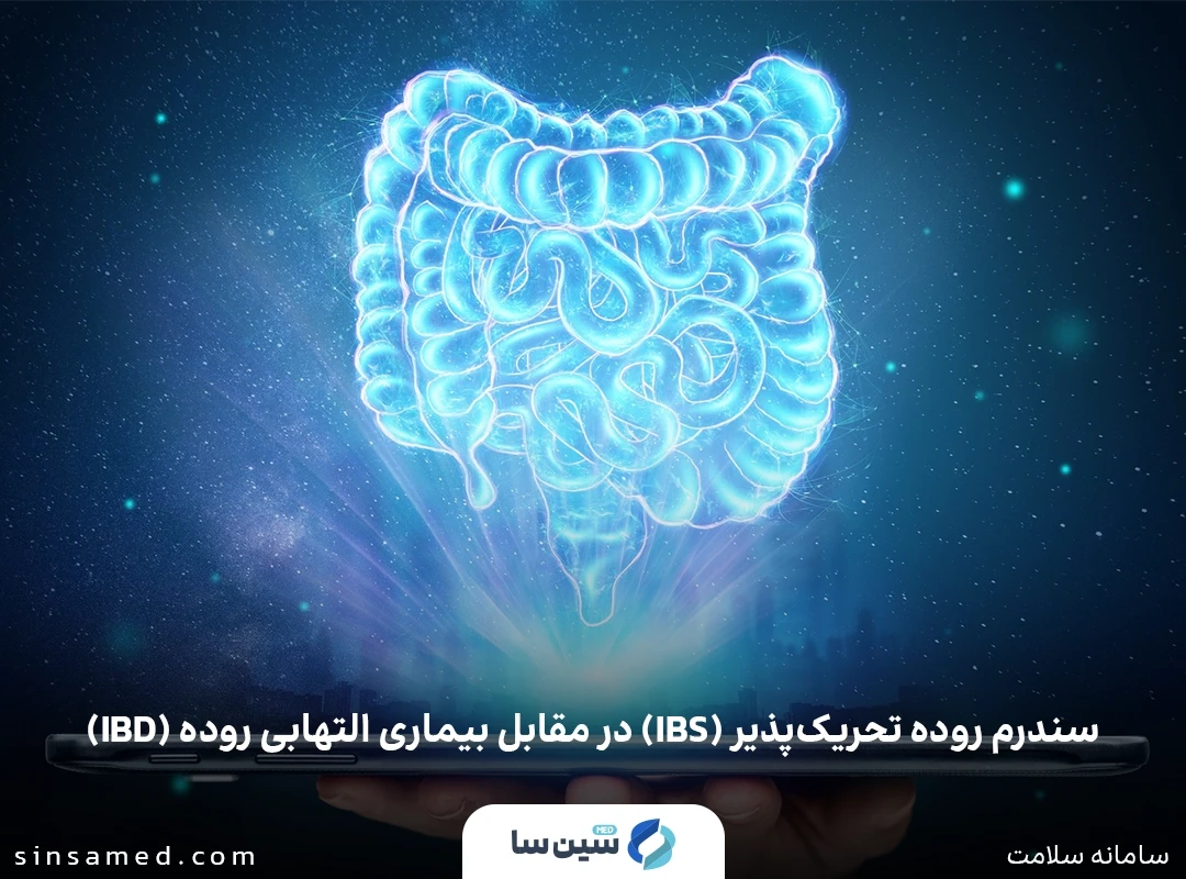 سندرم روده تحریک پذیر (IBS) در مقابل بیماری التهابی روده (IBD)