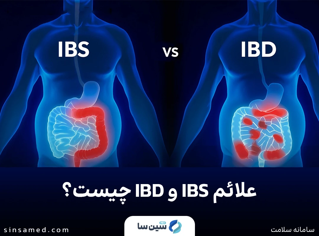 تفاوت علائم بیماری التهابی روده و سندروم روده تحریک‌پذیر