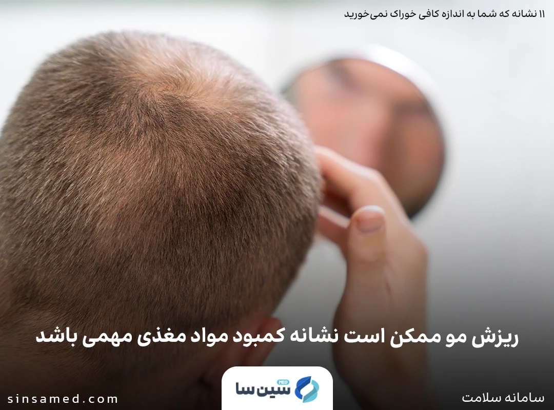 ریزش مو از نشانه های کمبود مواد مغذی