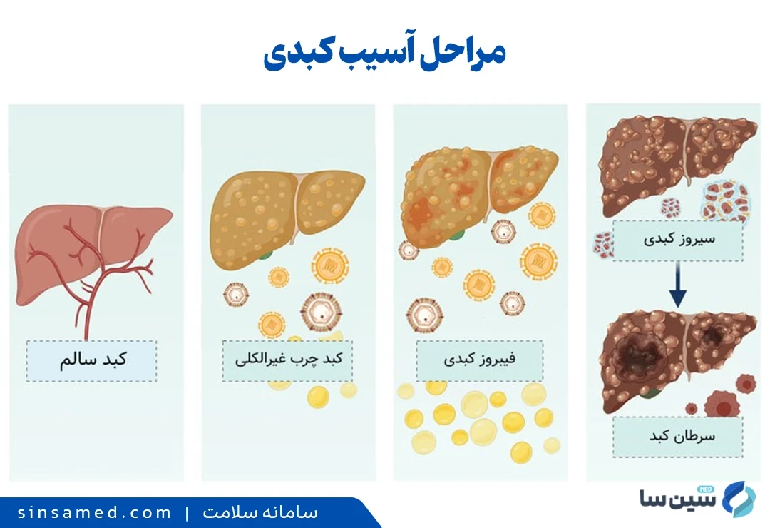 مراحل آسیب کبدی