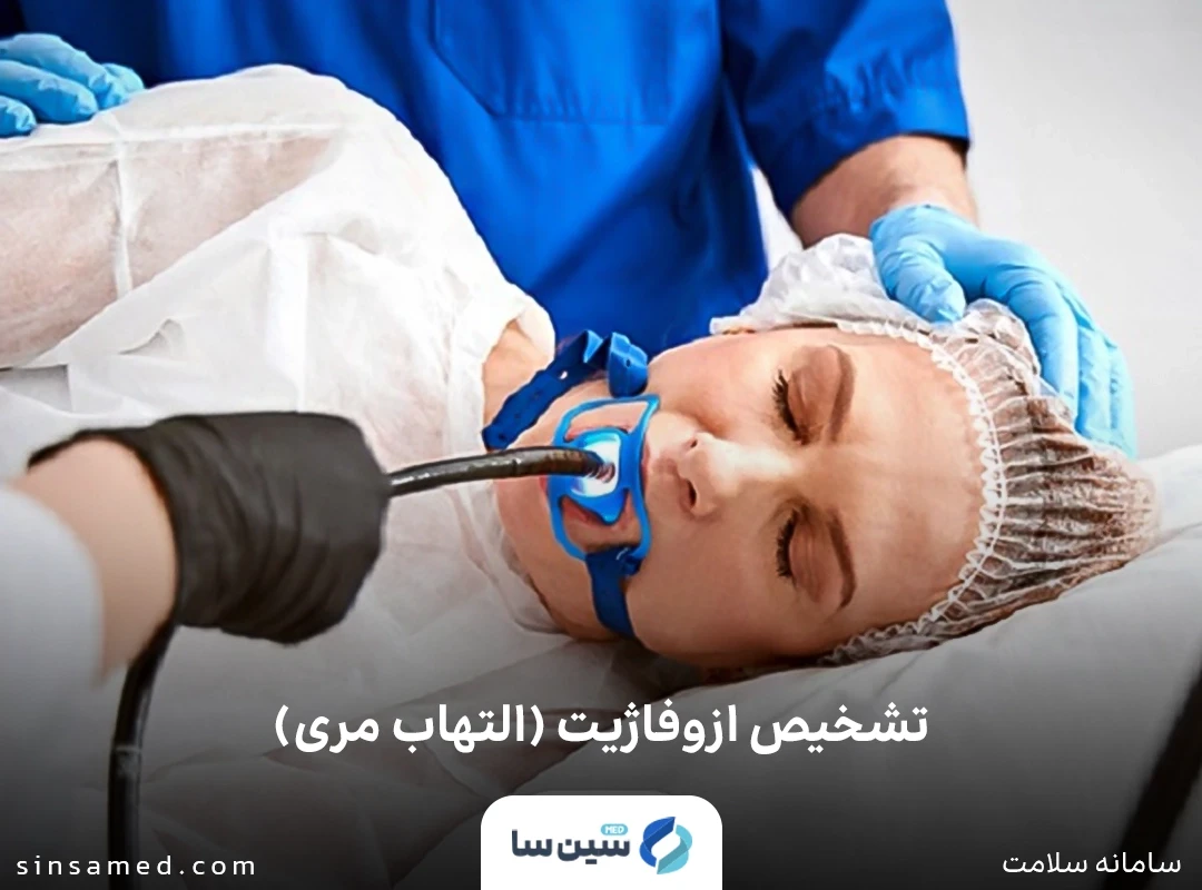 تشخیص ازوفاژیت (التهاب مری) با آزمایش آندوسکوپی