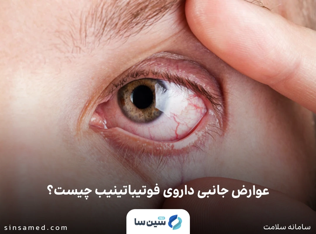عوارض جانبی داروی فوتیباتینیب چیست؟