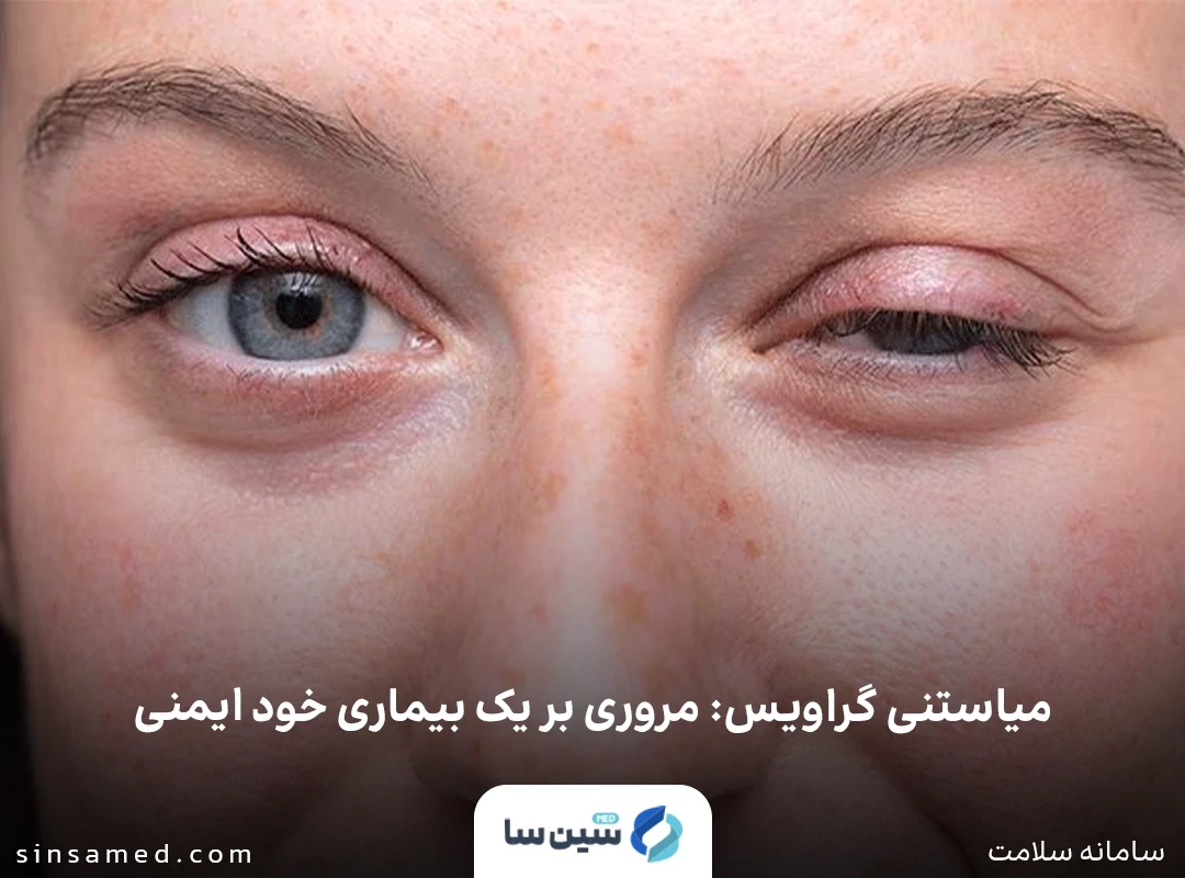 بیماری میاستنی گراویس