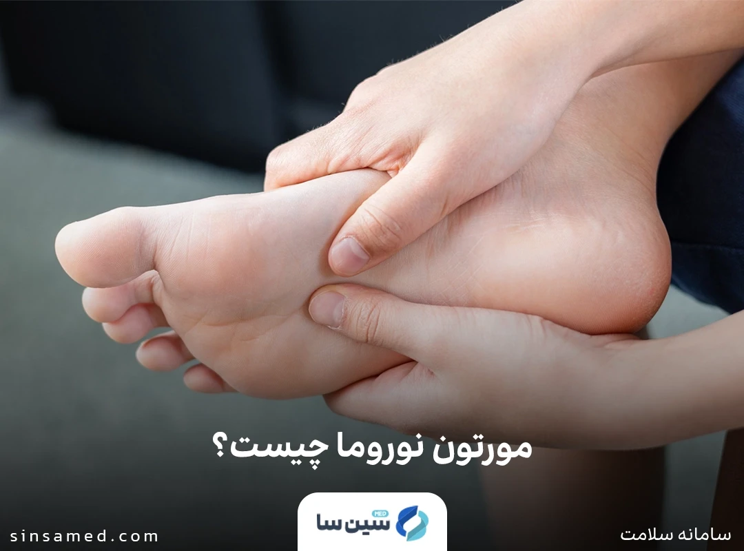 مورتون نوروما چیست؟
