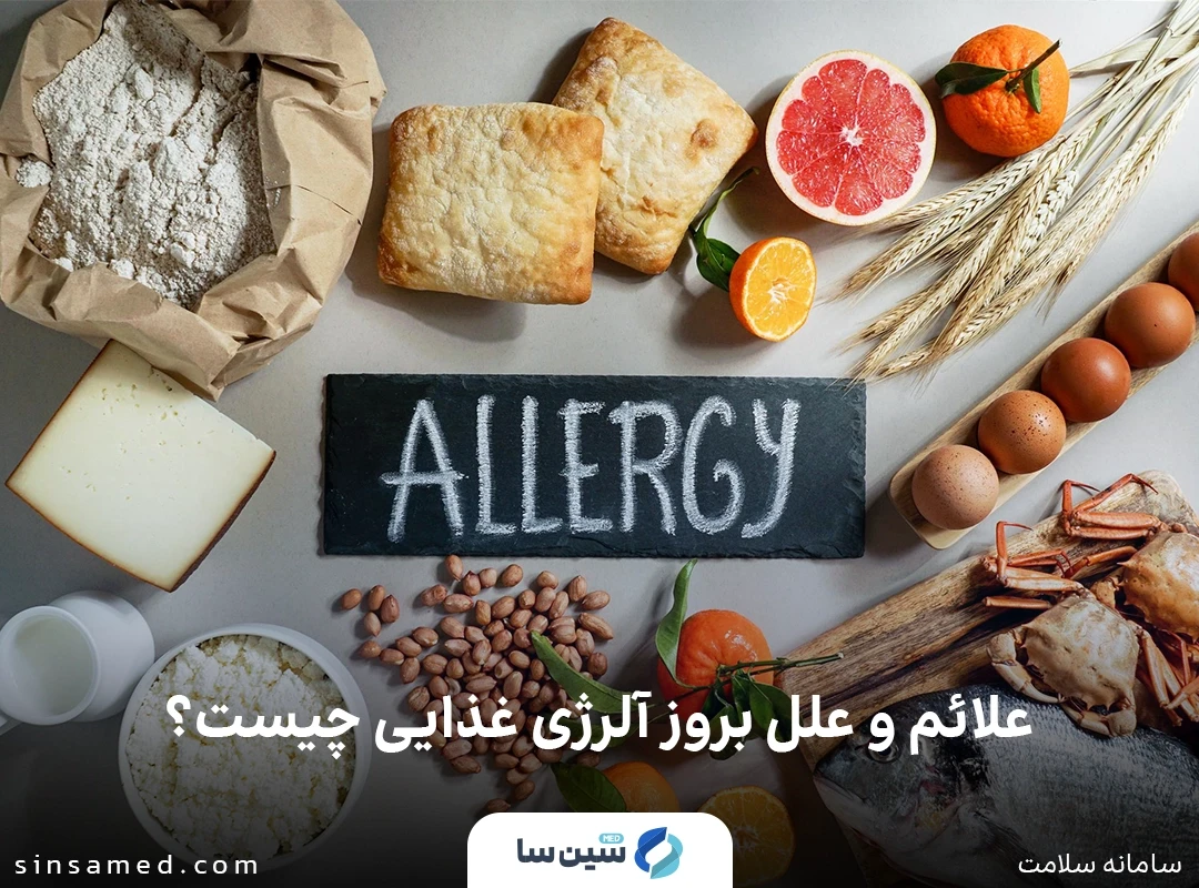 علائم و علل بروز آلرژی غذایی چیست؟