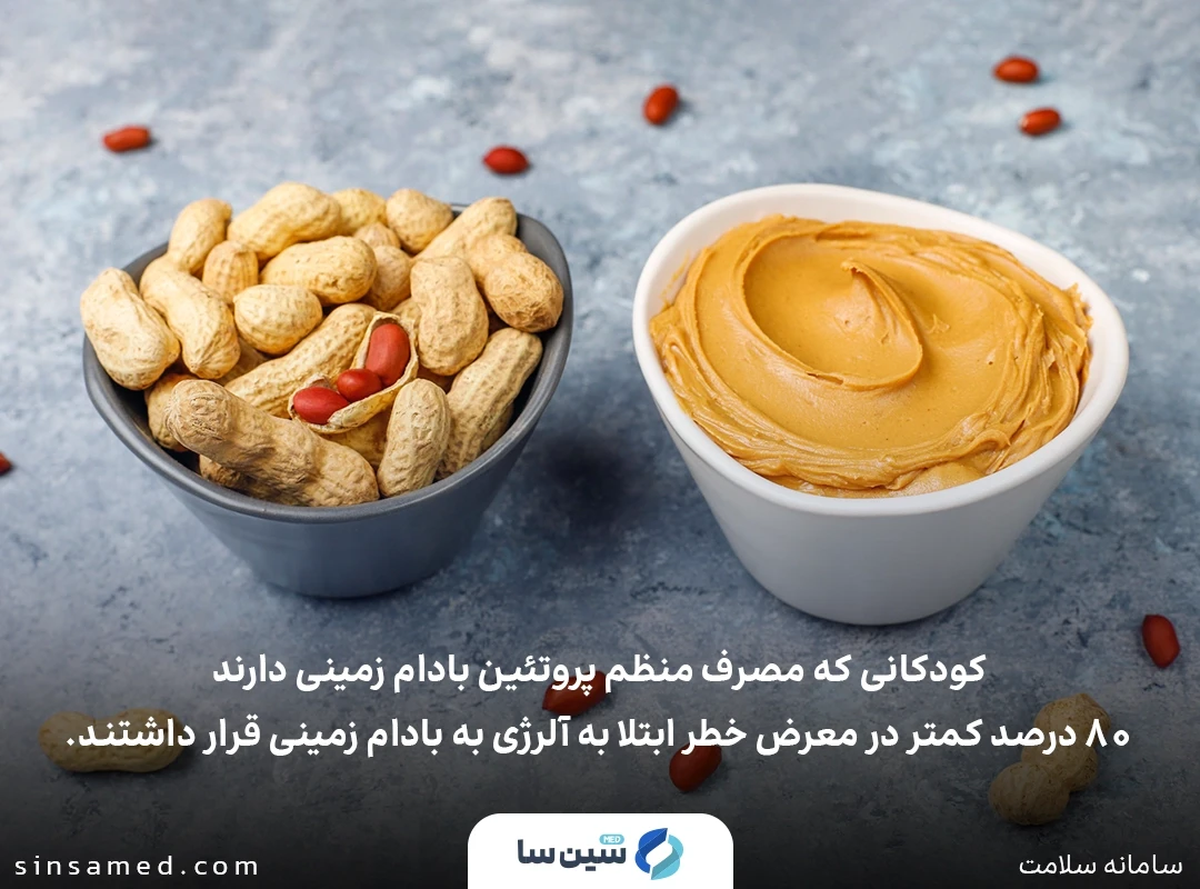 پیشگیری از آلرژی بادام زمینی