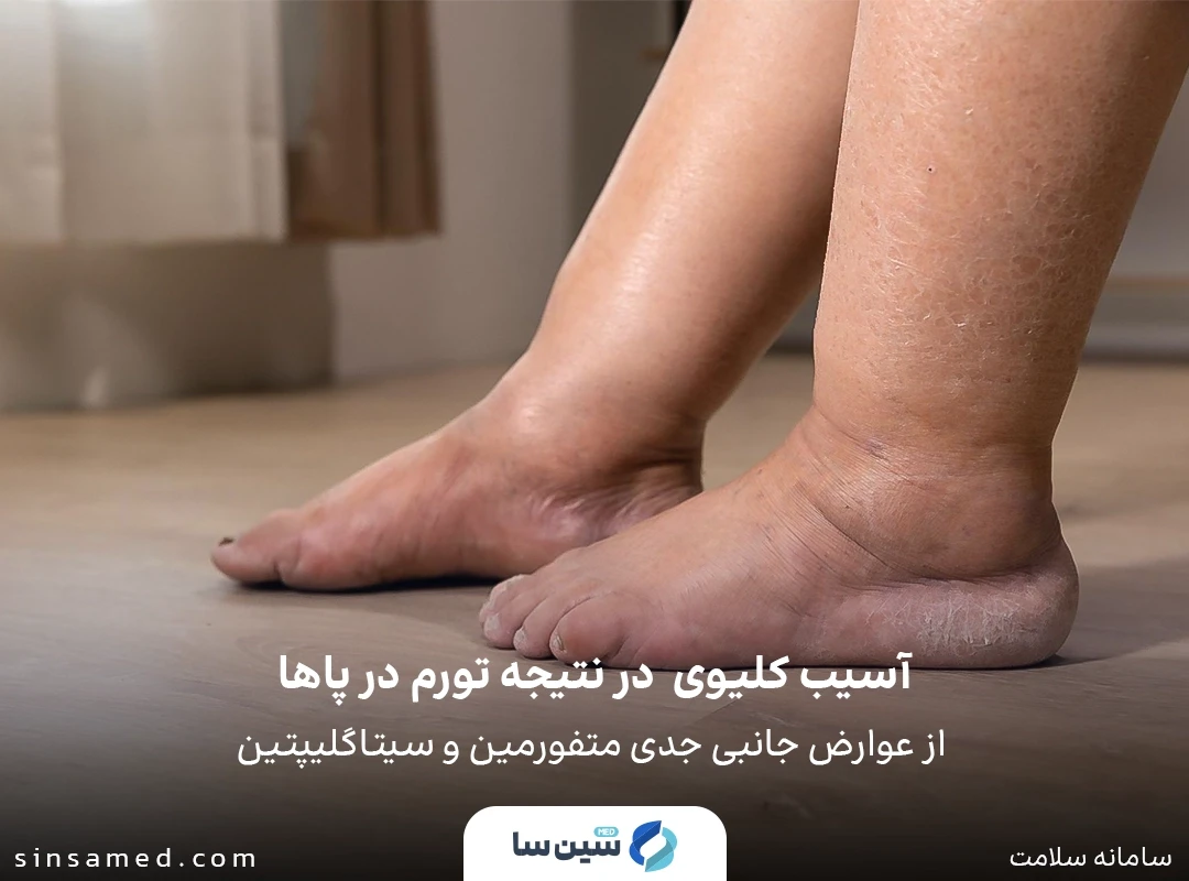 آسیب کلیوی از عوارض جانبی جدی متفورمین و سیتاگلیپتین 