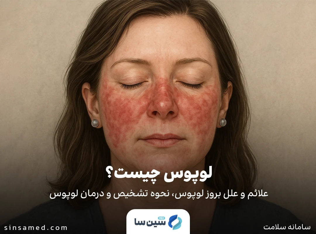 لوپوس: علائم، علل، تشخیص و روش های درمان