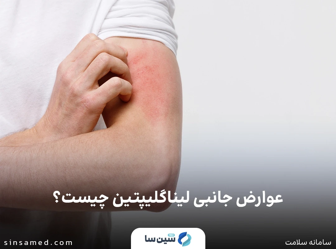 واکنش های پوستی از عوارض جانبی لیناگلیپتین 