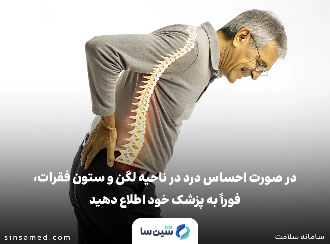 شکستگی استخوان از عوارض جانبی ناپروکسن / اس امپرازول