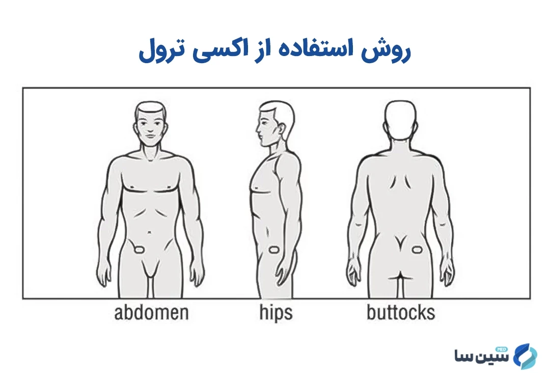 روش استفاده از اکسی ترول (پچ پوستی اکسی بوتینین) 