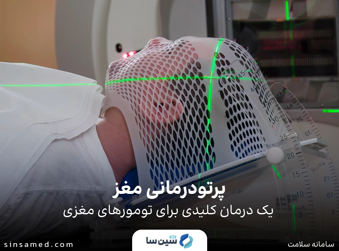 پرتودرمانی مغز