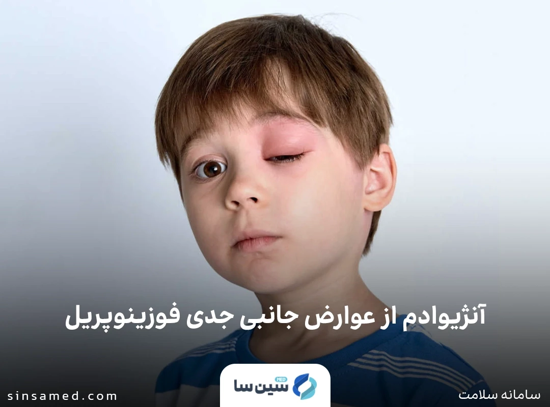 آنژیوادم از عوارض جانبی جدی فوزینوپریل