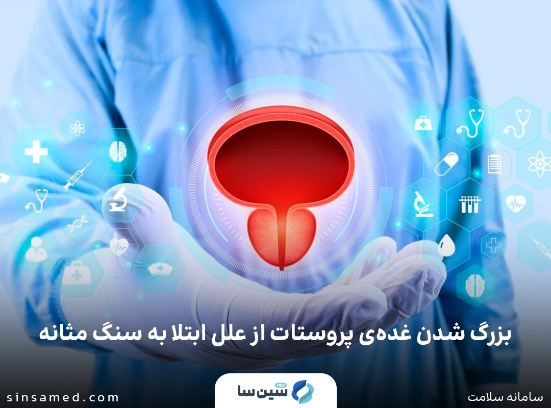 بزرگ شدن پروستات از علل ابتلا به سنگ مثانه