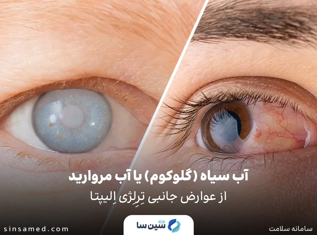 ابتلا به آب سیاه (گلوکوم) یا آب مروارید از عوارض جانبی داروی تِرِلِژی اِلیپتا