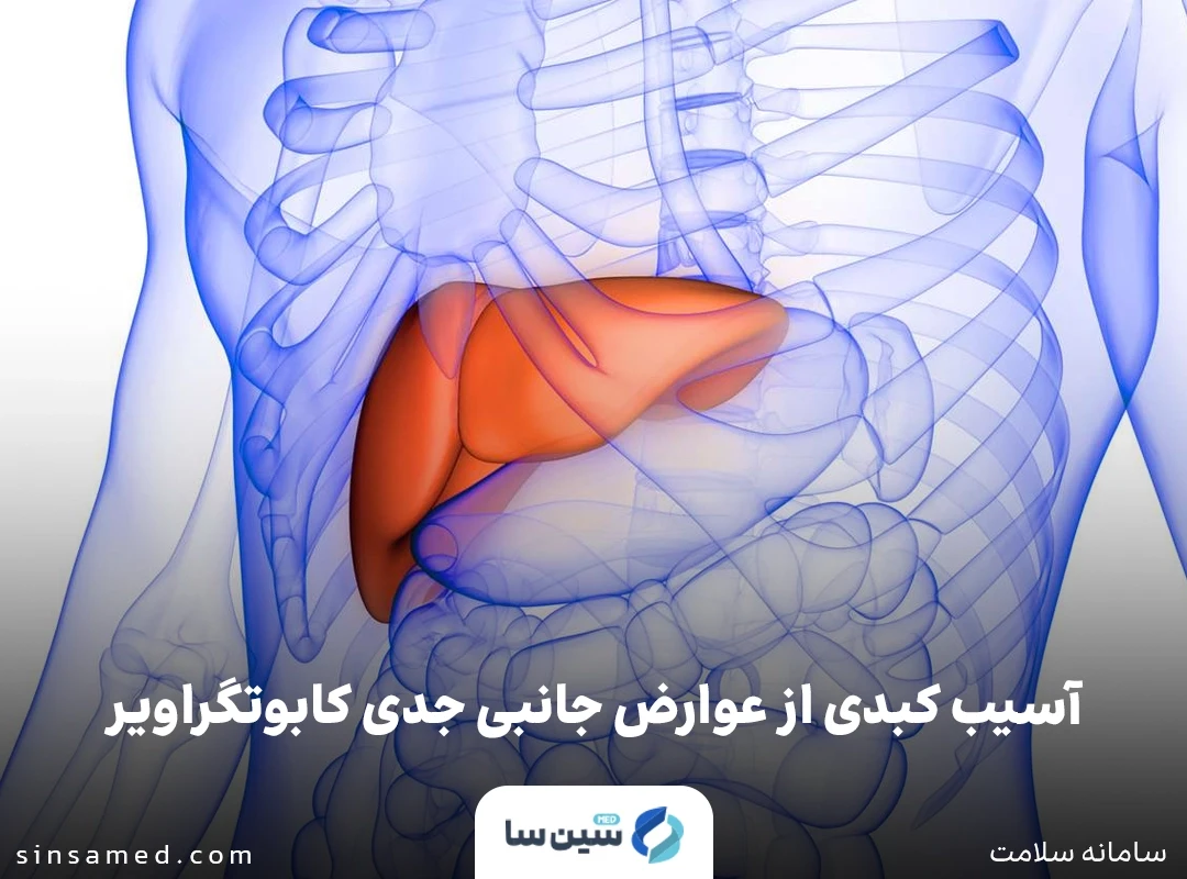 آسیب کبدی از عوارض جانبی جدی کابوتگراویر