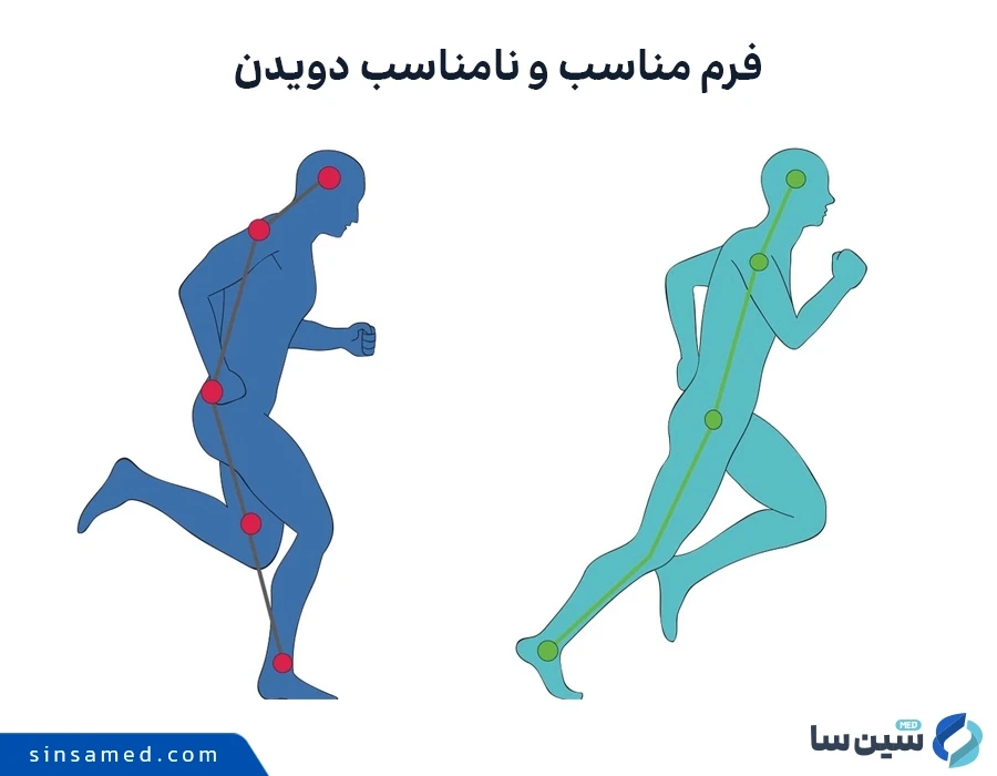 فرم مناسب و نامناسب دویدن از عوامل آسیب و فشار به زانوها