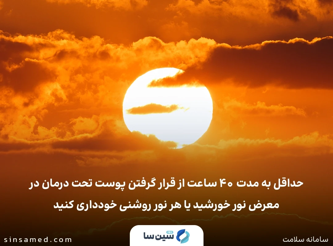 عدم قرار گرفتن در معرض نور آفتاب پس از استفاده از آمینولوولینیک اسید
