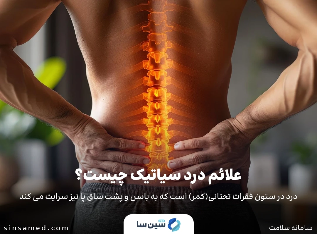 درد در ستون فقرات، باسن و پاها از علائم درد عصب سیاتیک