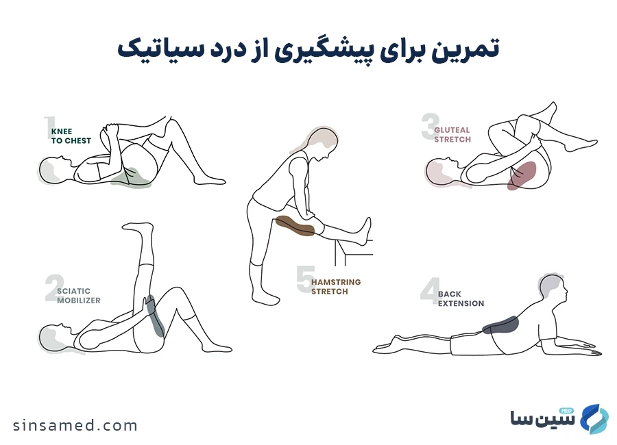 تمرین برای پیشگیری از درد عصب سیاتیک