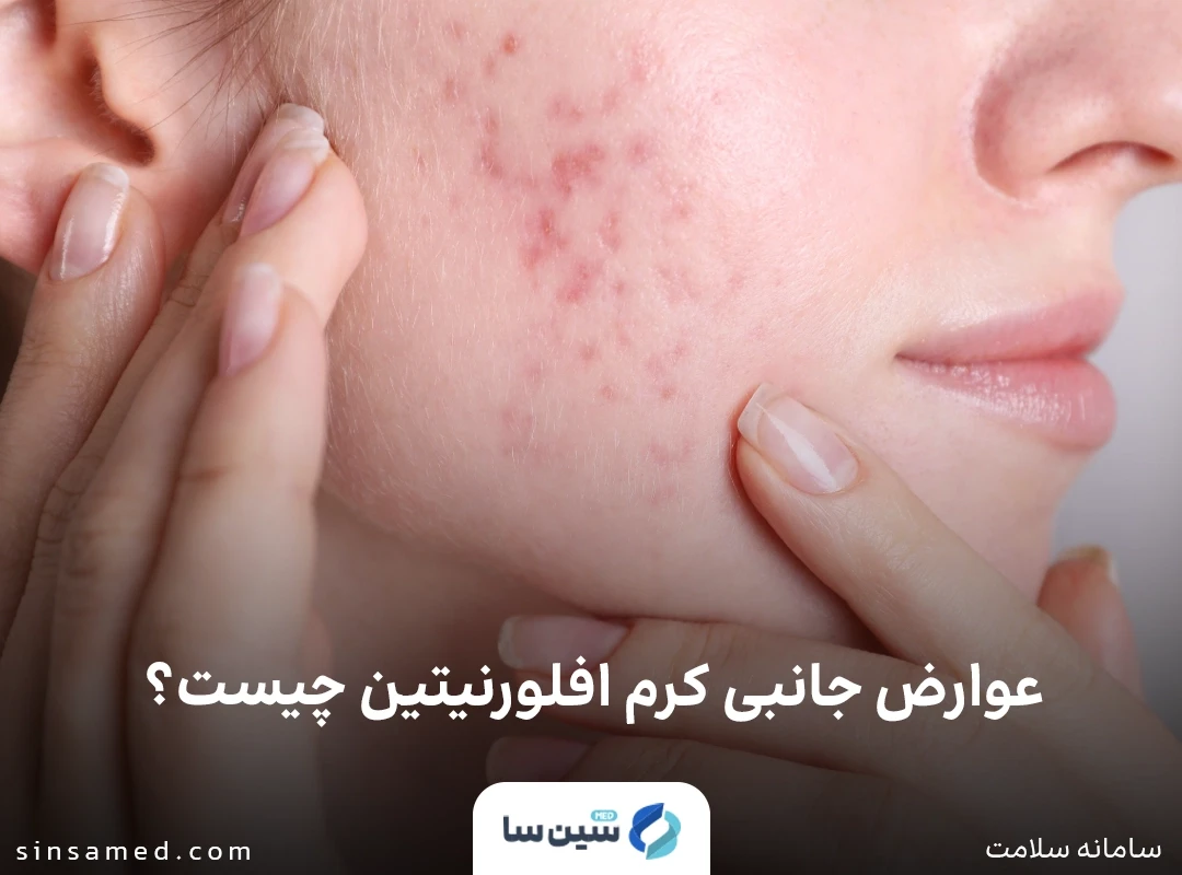 بروز بثورات پوستی از عوارض جانبی کرم افلورنیتین