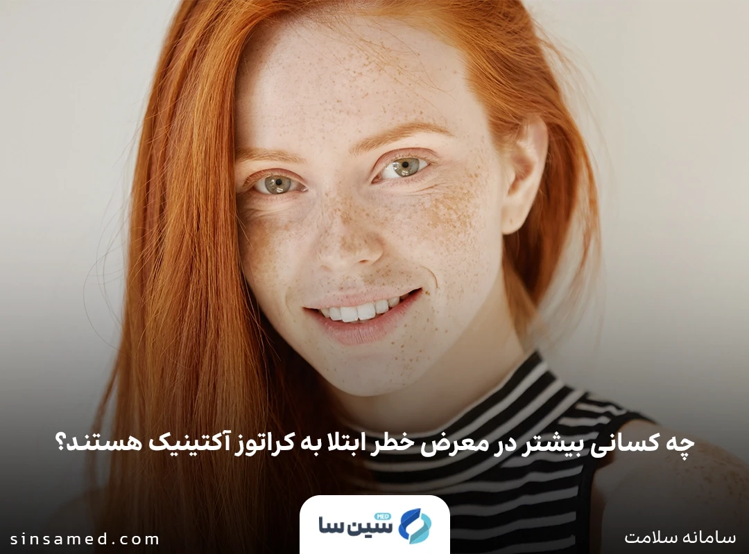 چشمان روشن و موهای قرمز یا بلوند از عوامل خطرساز کراتوز آکتینیک