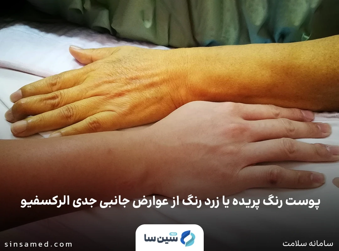 پوست رنگ پریده یا زرد رنگ از عوارض جانبی جدی الرکسفیو