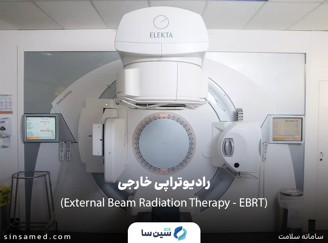 رادیوتراپی خارجی (External Beam Radiation Therapy - EBRT)