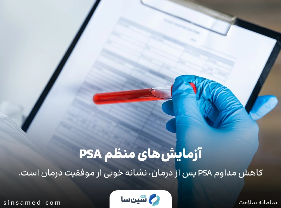 انجام آزمایش پی اس ای برای تشخیص عود مجدد پس از رادیوتراپی پروستات